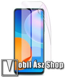 SUNSHINE TCL 205, SUNSHINE Hydrogel TPU képernyővédő fólia, Ultra Clear, Önregenerá (SUNS251673)