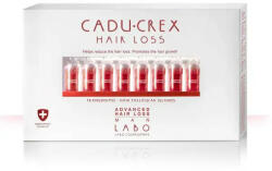 LABO - Tratament impotriva caderii parului stadiu sever barbati Cadu-Crex, 40 fiole, Labo - vitaplus