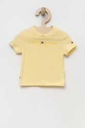 Tommy Hilfiger újszülött póló sárga, nyomott mintás - sárga 56