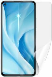 Screenshield XIAOMI 11 Lite 5G NE kijelzővédő fólia (XIA-11LT5GNE-D)