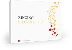 VitamindD Test (VitamindD Test)