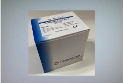  CRP gyorsteszt (Reader Plus) VedaLAB (20 db) (SUN691)