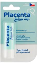 Regina méhlepény pálcika hólyag