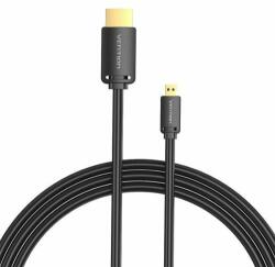 Vention HDMI-D Male to HDMI-A Male Cable Vention AGIBF 1m, 4K 60Hz (Black) (AGIBF) - wincity