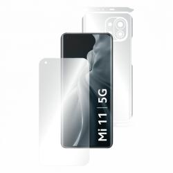 Folie AntiReflex Mata Smart Protection Xiaomi Mi 11 - smartprotection - 97,00 RON