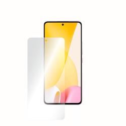  Folie AntiReflex Mata Smart Protection Xiaomi 12 Lite, 5G - smartprotection - 75,00 RON