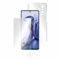Folie AntiReflex Mata Smart Protection Xiaomi Mi 11T 5G - smartprotection - 97,00 RON