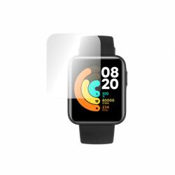 Folie de protectie Smart Protection Smartwatch Xiaomi Mi Watch Lite - smartprotection - 45,00 RON