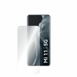 Folie AntiReflex Mata Smart Protection Xiaomi Mi 11 - smartprotection - 75,00 RON