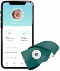 Owlet Smart Sock 3 Aparat supraveghere bebelus