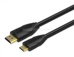 Vention mini HDMI/M -> HDMI/M 1m, kábel (fekete) (VAA-D02-B100) (VAA-D02-B100)