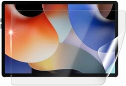 Screenshield OSCAL Pad 10 védőfólia (OSC-PAD10-D)