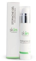 Yamuna skIN by Yamuna STOP! ACNE gél pattanásos bőrre 50 ml
