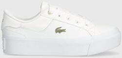 Lacoste sneakers Ziane Platform Logo Leather PPYH-OBD2PD_00X (47CFA0005)