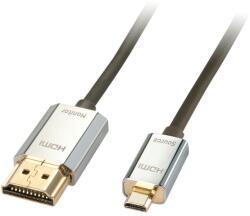Lindy 41679 HDMI kábel HDMI A-típus (Standard) HDMI D-típus (Micro) Fekete (41679) (41679)