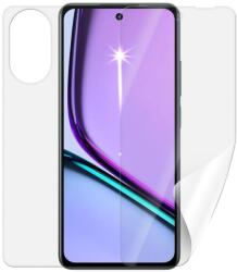 Screenshield REALME C67 védőfólia (RLM-C67-B)