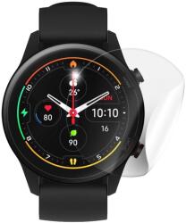 SUNSHINE 6 db Hidrogél fólia Mi Watch STANDARD MINŐSÉG