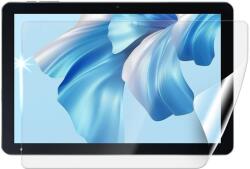 Screenshield OSCAL Pad 60 védőfólia (OSC-PAD60-D)