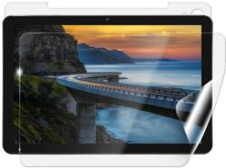 Screenshield IGET Smart W30 védőfólia (IGT-SMW30-B)