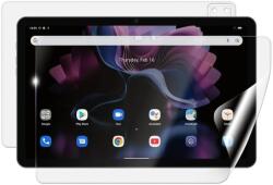 Screenshield IGET Blackview TAB G16 védőfólia (IGT-BVTABG16-B)