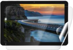 Screenshield IGET Smart W30 védőfólia (IGT-SMW30-D)