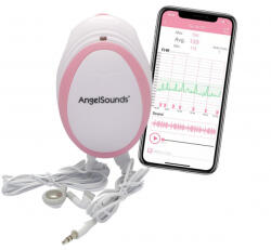 Angelcare AngelSounds magzati szívhanghallgató okostelefonhoz