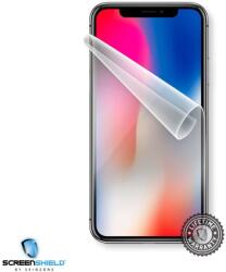 Screenshield APPLE iPhone X kijelzővédő fólia (APP-IPHX-D)