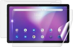 Screenshield IGET Blackview TAB G11 SE védőfólia (IGT-BVTABG11SE-B)