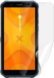 Screenshield MYPHONE Hammer Energy X védőfólia (MYP-HENRGX-D)