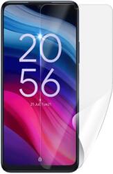 Screenshield TCL 505 védőfólia (TCL-505-D)