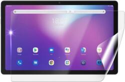 Screenshield IGET Blackview TAB G11 SE védőfólia (IGT-BVTABG11SE-D)