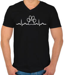 printfashion Tappancs ekg - Férfi V-nyakú póló - Fekete (5377812)