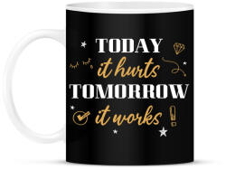 printfashion Ma fáj, holnap működik - Bögre - Fekete (12611044)