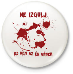 printfashion Nem az év vérem - Kitűző, hűtőmágnes - Fehér (8755856)