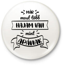 printfashion Már most több hajam van - Kitűző, hűtőmágnes - Fehér (7276584)