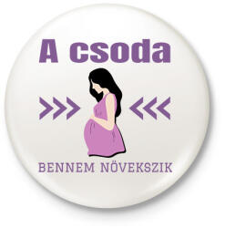 printfashion A csoda bennem növekszik - Kitűző, hűtőmágnes - Fehér (15729669)
