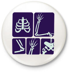 printfashion Röntgen - Kitűző, hűtőmágnes - Fehér (15678680)