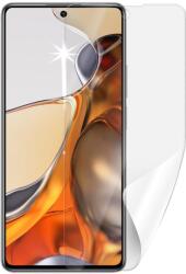 Screenshield XIAOMI 11T Pro kijelzővédő fólia (XIA-11TPR-D)