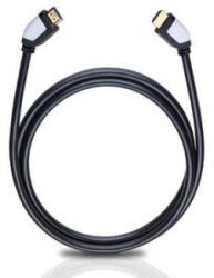 Oehlbach Shape Magic HDMI kábel 1.7 méter fekete (OB42461) (OB42461)
