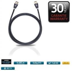 Oehlbach Easy Connect 75 Ethernet képes HDMI kábel 0, 75 m (OB 126) (OB 126)