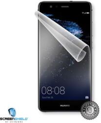 Screenshield HUAWEI P10 Lite képernyővédő fólia HUA-P10LT-D