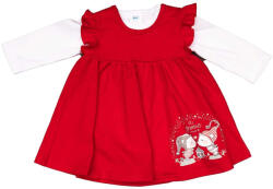 Asti 2 részes alkalmi baba ruha szett Manós mintával