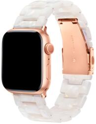 SmartWatcherz Apple Watch Műgyanta Szíj (49034745086280)