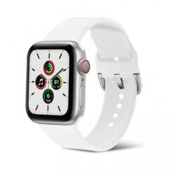 SmartWatcherz Apple Watch Csatos Szilikon Szíj (49033432072520)