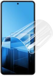 IMAK HYDROGEL Védőfólia a Asus Zenfone 11 Ultra-hez