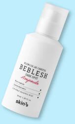 skin79 Ser pentru imperfecțiuni Beblesh Dark Spot Ampoule - 50 ml