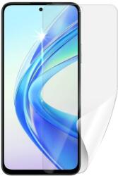 Screenshield HUAWEI Honor X7b védőfólia (HUA-HONX7B-D)