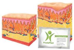 ProstaPlast Plasturi urologici, ProstaPlast, trans-dermici