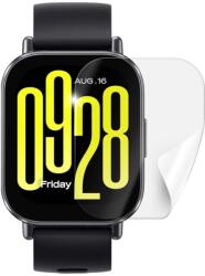 ScreenShield XIAOMI Redmi Watch 5 Active üvegfólia (XIA-REDWA5AC-D)