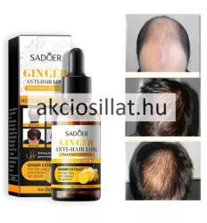 SADOER Ginger Hajhullás Elleni szérum 30ml